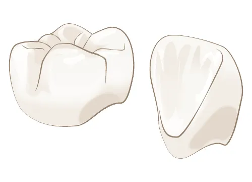 セラミック治療